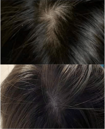 头皮|这3类洗发水列入“黑名单”，皮肤科主任都避开，新手妈妈还买？