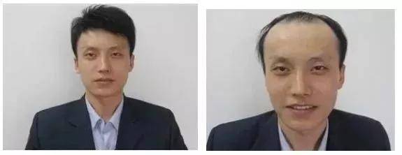 头发|别人脱单你脱发？秃头？油头？你真的应该怪洗发水！