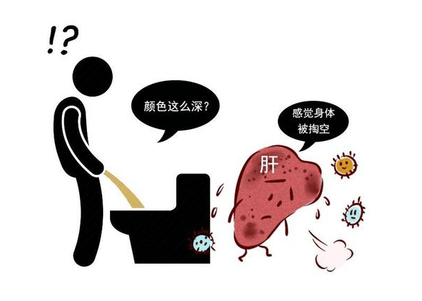治疗|小便时2种症状频繁出现,肝脏或已“烂透”,牢记4点肝癌绕道走
