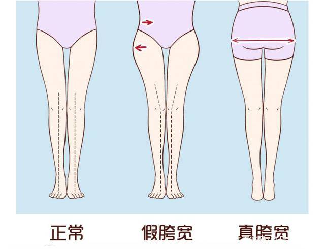 身材|胯宽屁股大的女人怎么穿？找准身材、避开雷区，遮肉显瘦又显高