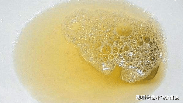 控制|糖尿病患者要预防糖尿病肾病,出现以下5个问题,健康危害就大了