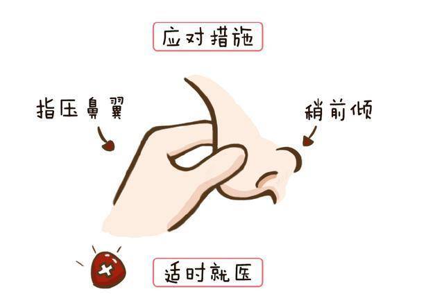 鼻血|孩子流鼻血就仰头？做错了！不能这样