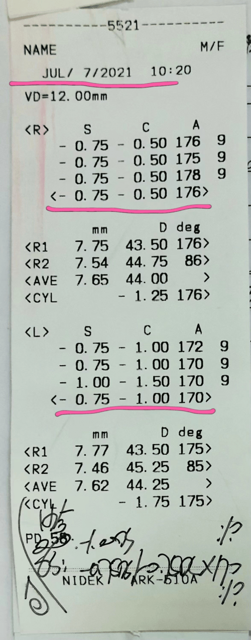 严宏|【角膜塑形镜案例】宜昌8岁近视女孩的角膜塑形镜之路！