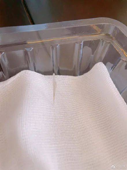 经历|张杰连夜做胃镜麻醉摘鱼骨，炸出一堆“吃鱼困难星人”