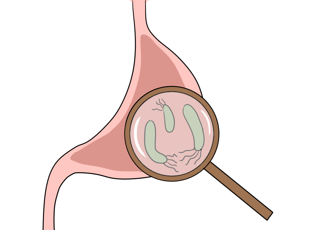 筛查|一人中招全家感染！传播幽门螺杆菌，全在这4个动作里！