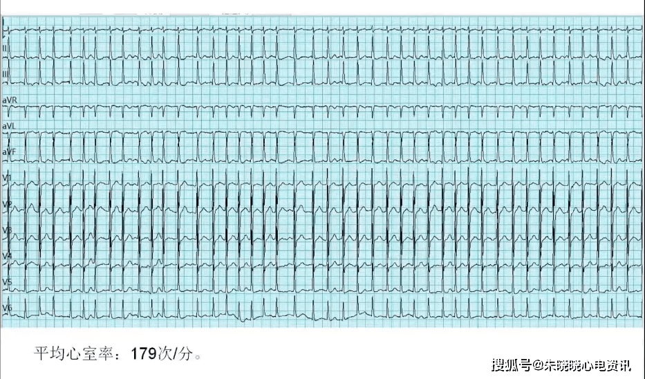 bbd594930f674d21ae78db9bf4d09fdb.png