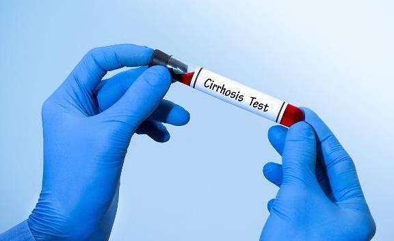 治疗|乙肝五项怎样才算正常？这种情况是乙肝五项最好的结果！