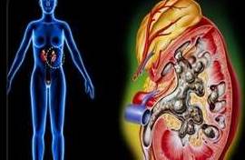 气血|肾结石可以这样去掉!大部分人都不知道