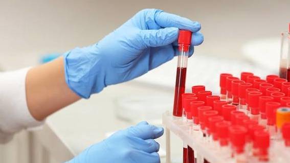 饮食|这些食物是肾脏的“隐形杀手”，肾友饮食记住3点，远离肾衰竭