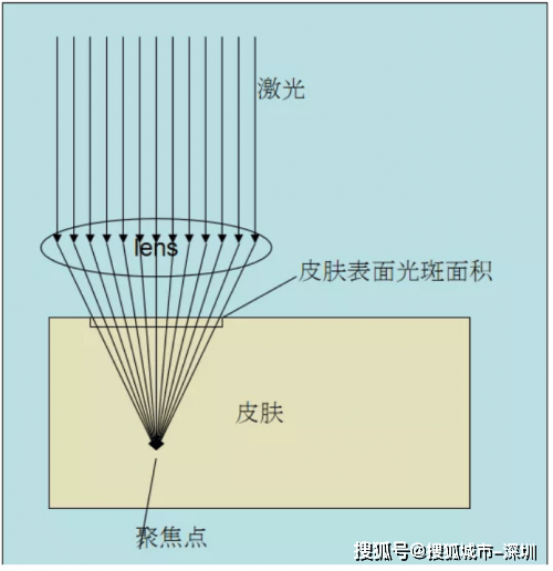 玛吉|热玛吉同门姐妹：飞梭镭射Fraxel美白、缩毛孔绝了！