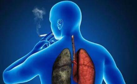 功能|肺气肿病发的原因是什么？