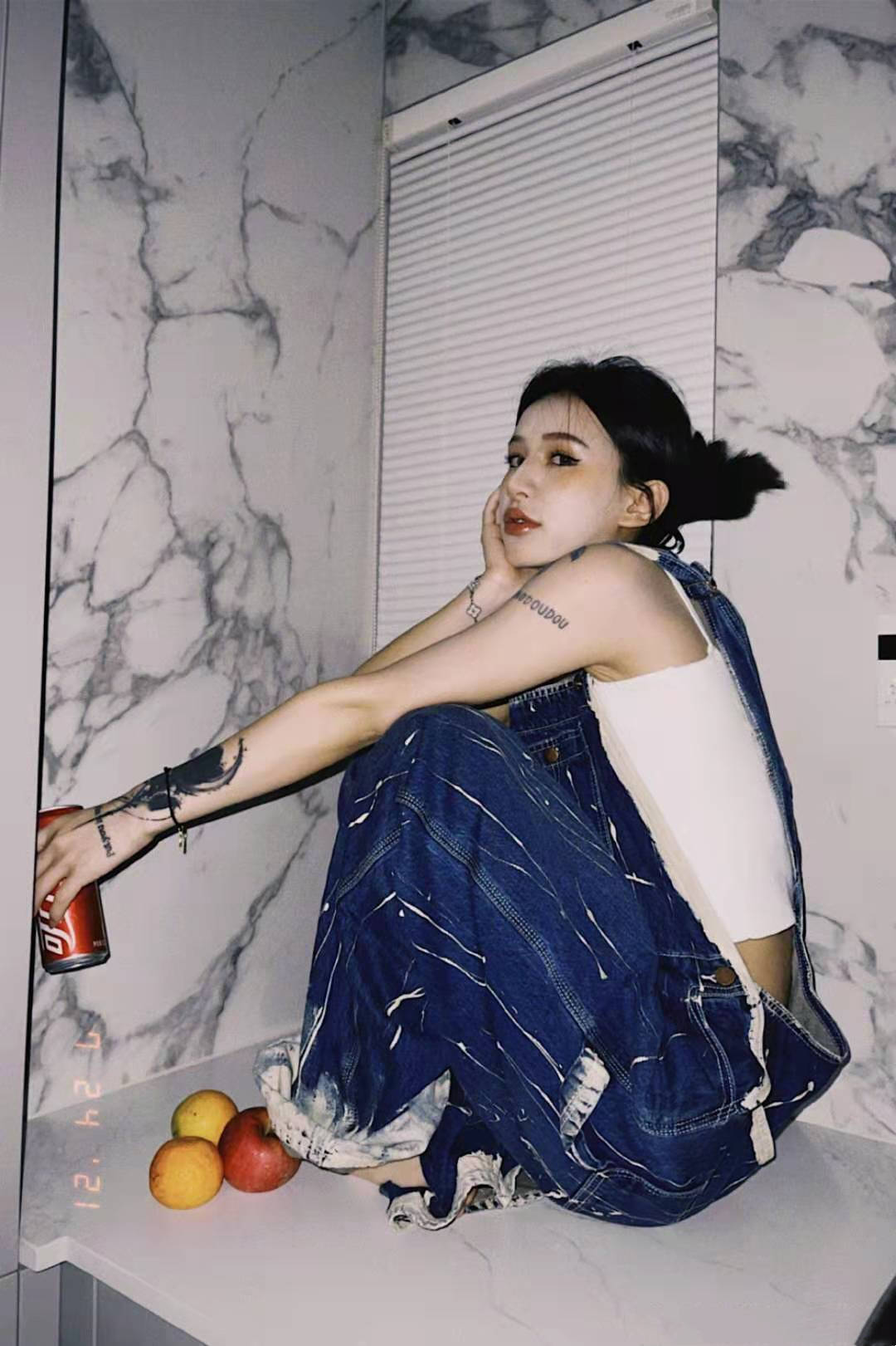 原创王逗逗晒出恋人车祸照眼皮青紫又流血万幸只是皮肉伤