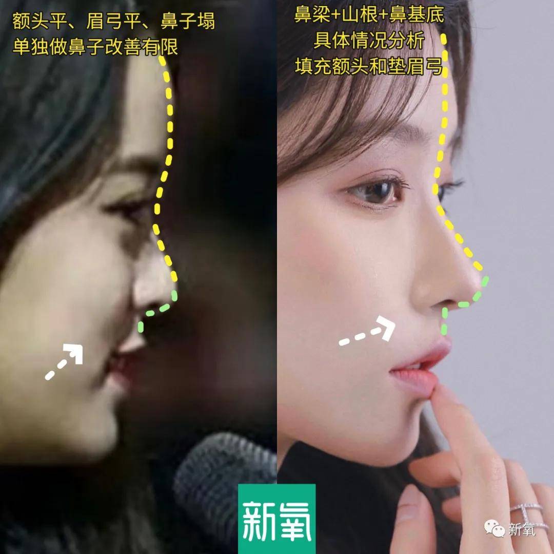 平面|作为被力捧多次的古偶女主,侧颜却被男主吊打的还第一次见