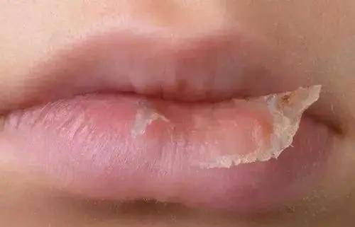 双唇|唇部对女生来说有多重要?我劝你重视…