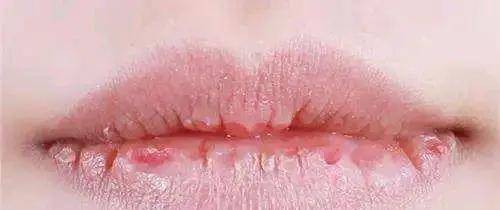 双唇|唇部对女生来说有多重要?我劝你重视…