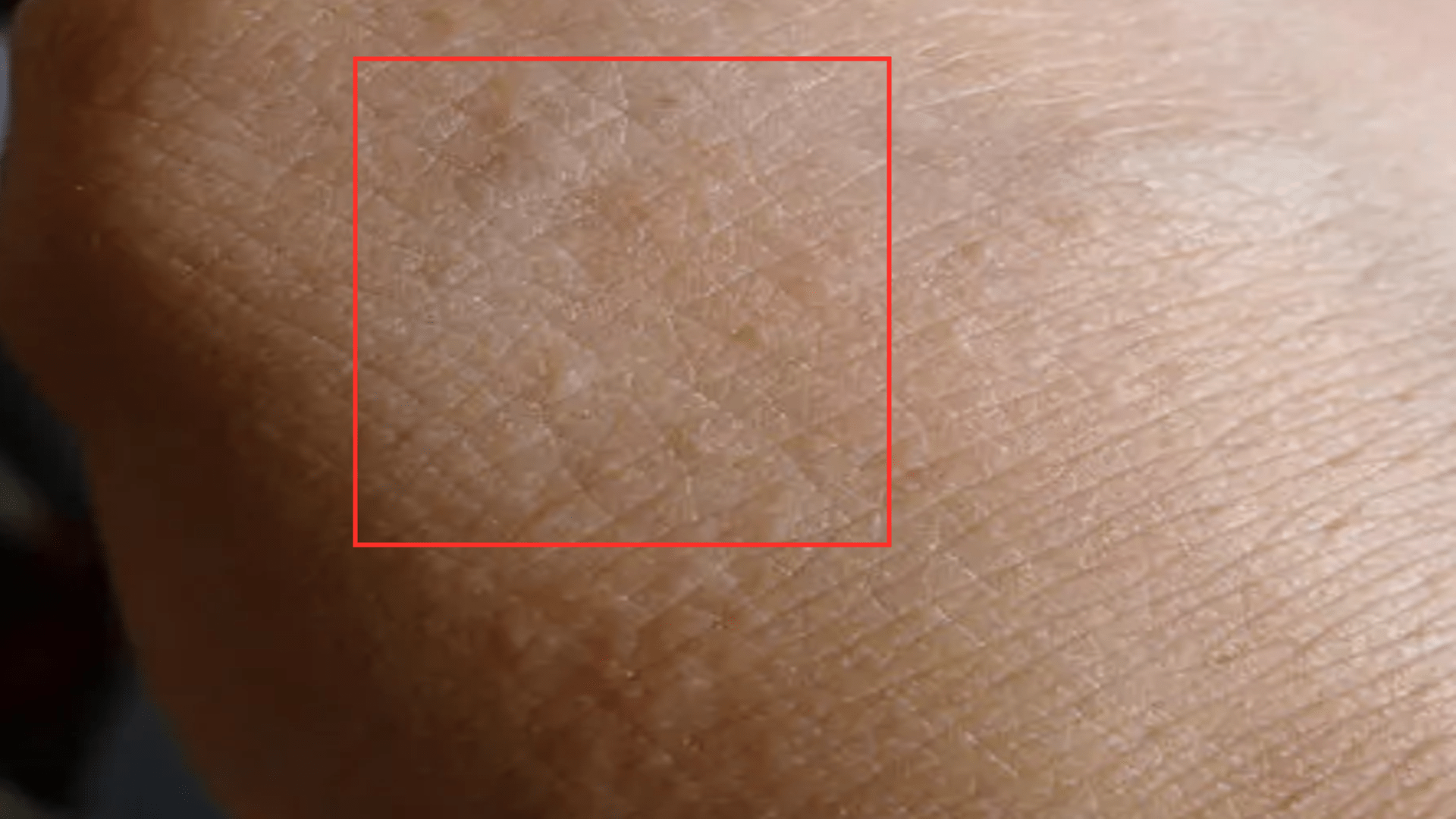 春夏秋冬|身体湿气重的表现有哪些？自测表来了，来一波干货给大家