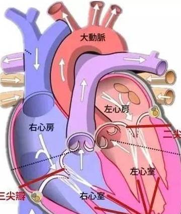 什么|心脏彩超提示二尖瓣，三尖瓣轻度返流是什么意思？该怎么办？