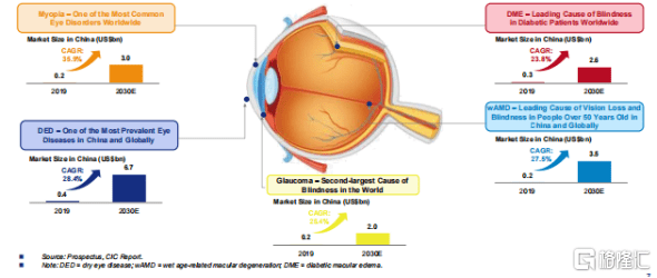 兴齐|兆科眼科-B(6622.HK)：一家被低估的眼科创新药企业