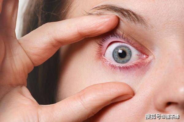 食欲|肝硬化患者，身体出现4个“变化”，肝硬化或在慢慢好转