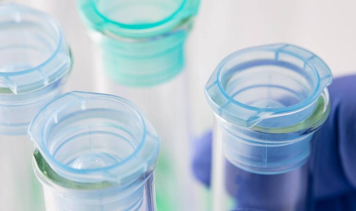 进行|为什么综合管理心血管疾病,需要警惕糖尿病肾病?