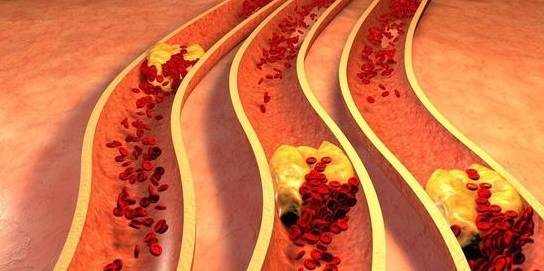 烟草|糖尿病人若烟不离手，要不了多久，4个危害会“登门”，莫大意