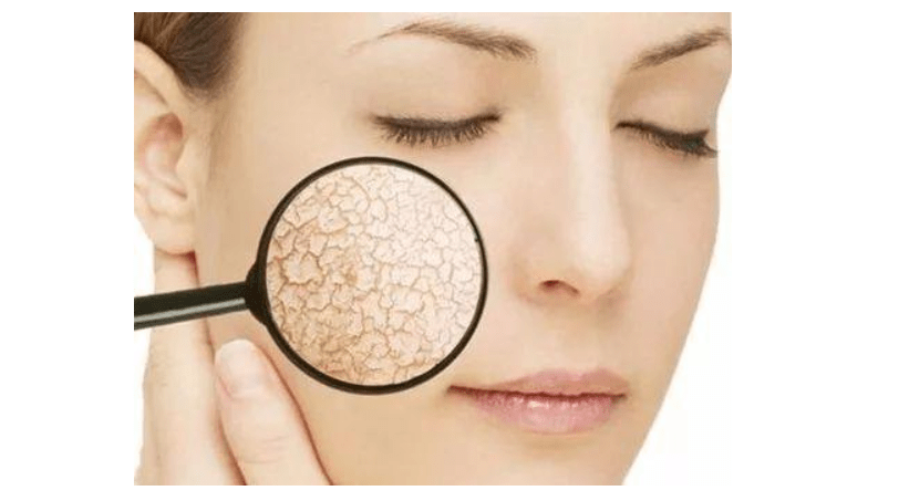 皮肤保湿因子是什么 048379182c1849708d9a10a6a773e344.png