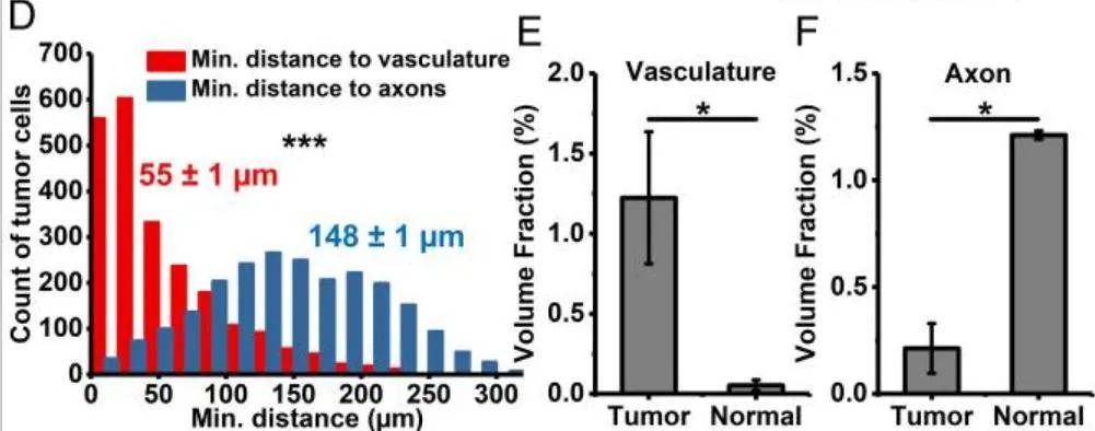 3D成像：肿瘤及病理组织中的应用