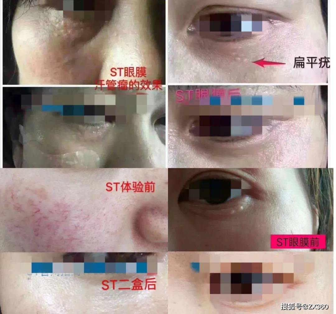 底线|乱价现象下宾奎国际的六级代理制度涉嫌传销，无底线虚假宣传还能走多远？