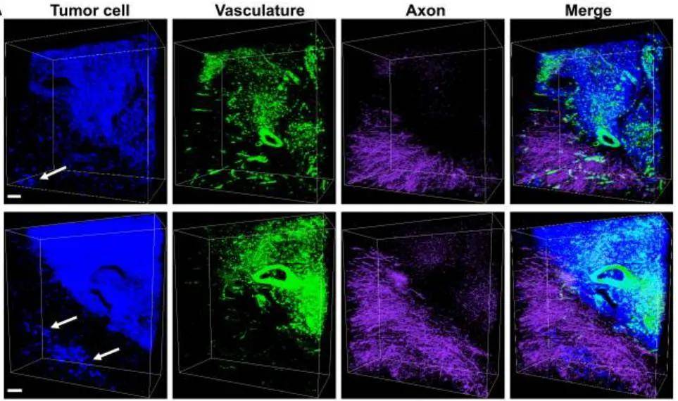 3D成像：肿瘤及病理组织中的应用