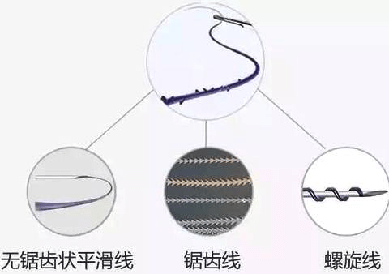 什么|面部抗衰 线雕适合哪些人做？禁忌是什么？线雕修复有多难？