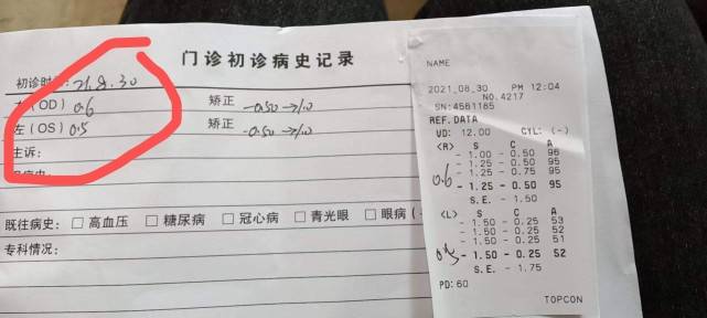 近视眼检测结果怎么看