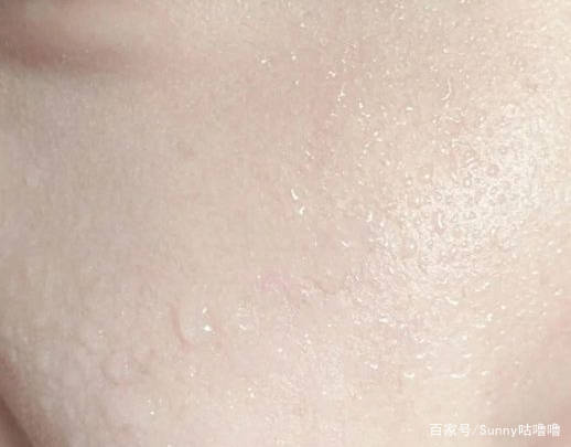 产品|还买这“三类成分”的护肤品？孕期上脸就过敏，第一个大家都用过