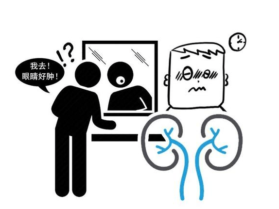 症状|慢性肾病患者近期出现5个症状，需警惕，这或说明尿毒症即将来临