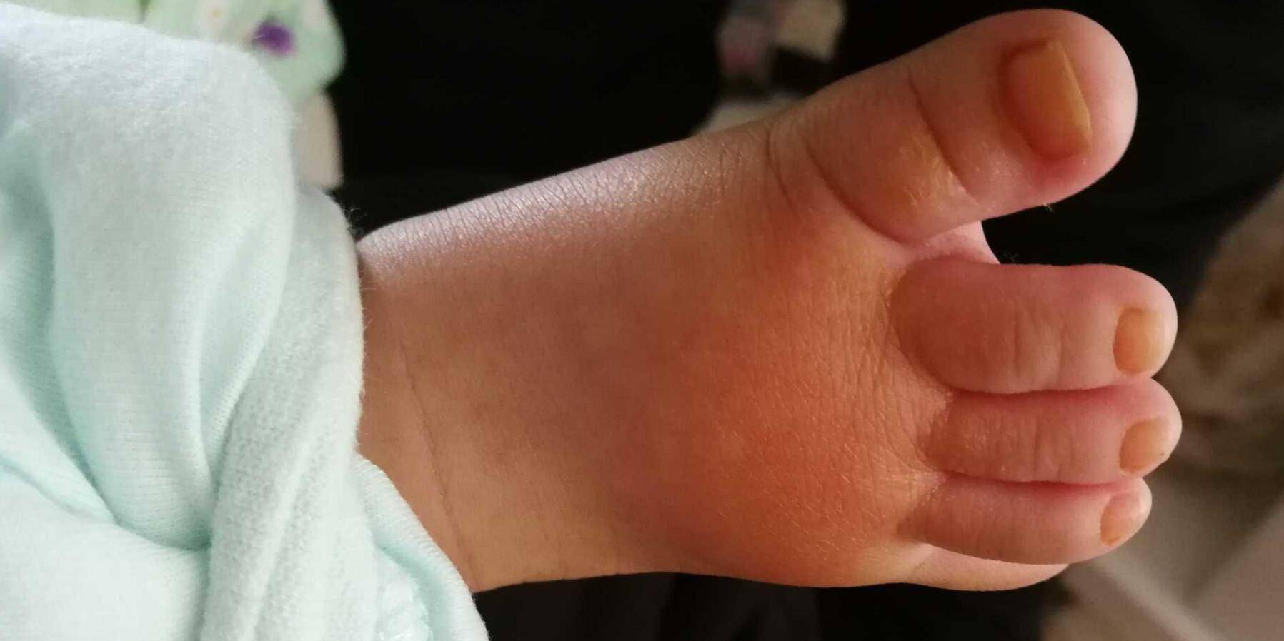 原创寒从脚底起,宝宝衣服可以少穿,袜子必须套上,这种做法正确吗?