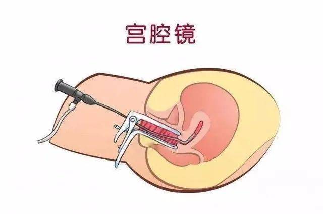 影响|绝经后内膜增厚要紧吗？泌乳素高了要吃药吗？