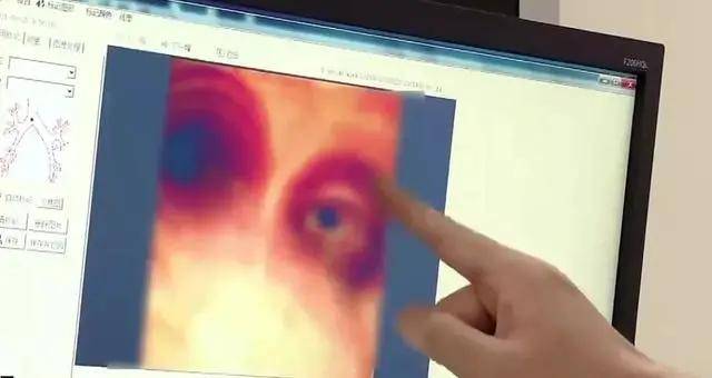 哨子|6岁吞哨子怕被骂，隐瞒父母20年：不敢说的背后，藏着多少痛？