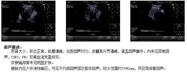 京东方|合肥京东方医院品质服务 术后患者生命体征平稳