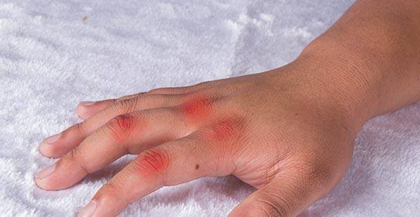 类人|哪些人不能喝酒?肝病医生呼吁:在榜人群尽量一口酒都别沾