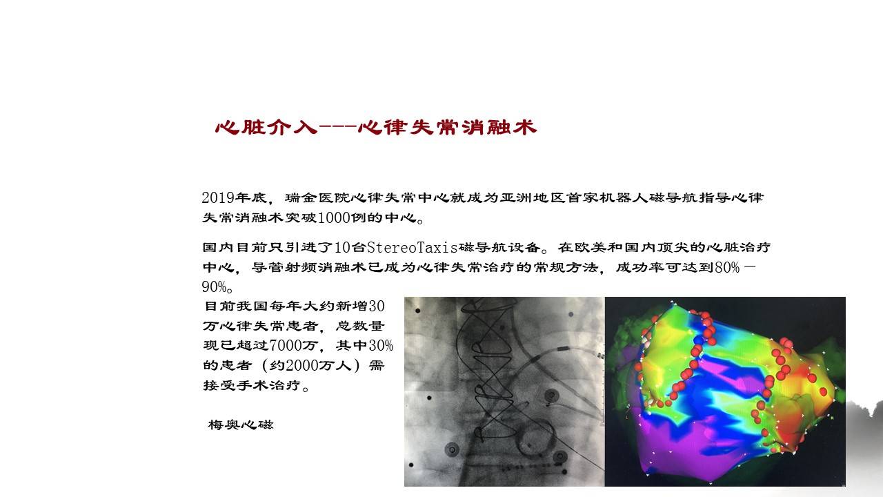 机器人|血管介入机器人的现状与展望