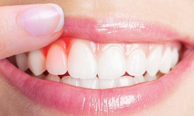 肝脏|肝脏问题隐匿又难缠！不过身体会用4种方式提醒你，早知道早预防