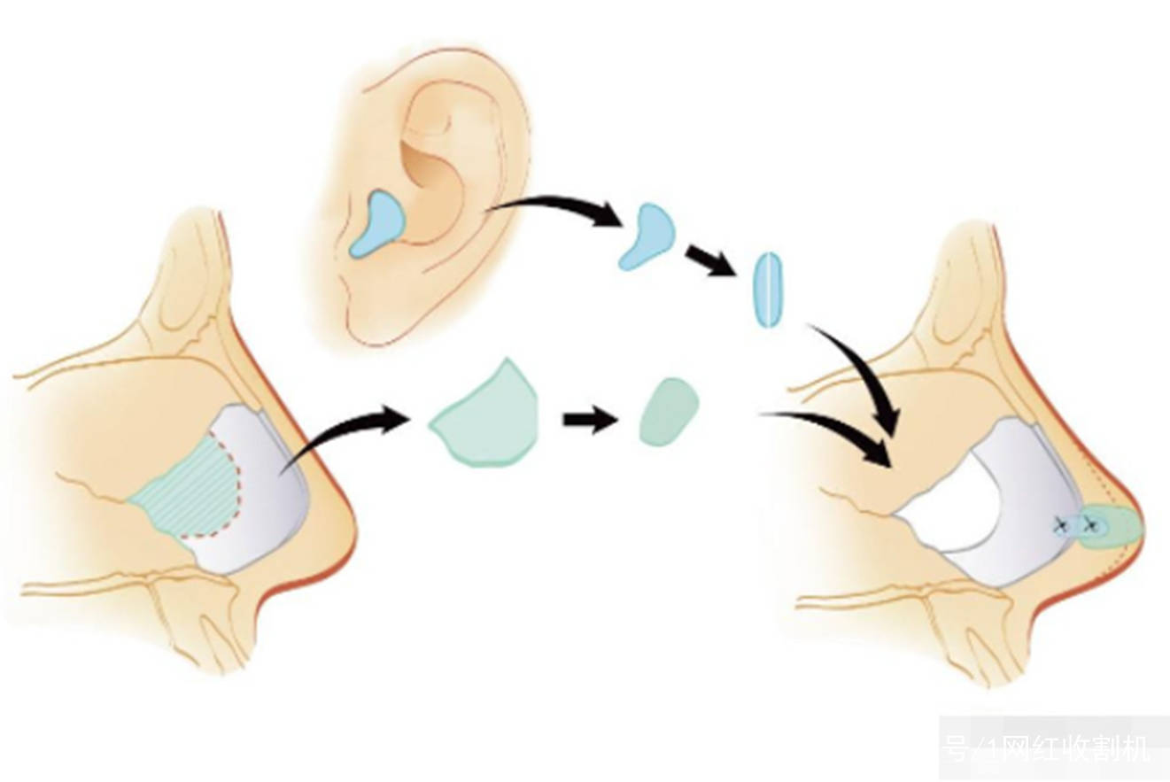 隆穹|太尴尬了!盘点8位明星“改头换面”后车祸现场,都是灾难(下)
