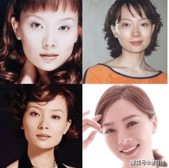 颧骨|做了颧骨内推的明星真的变美了吗？推平容易后悔难，后遗症一大堆