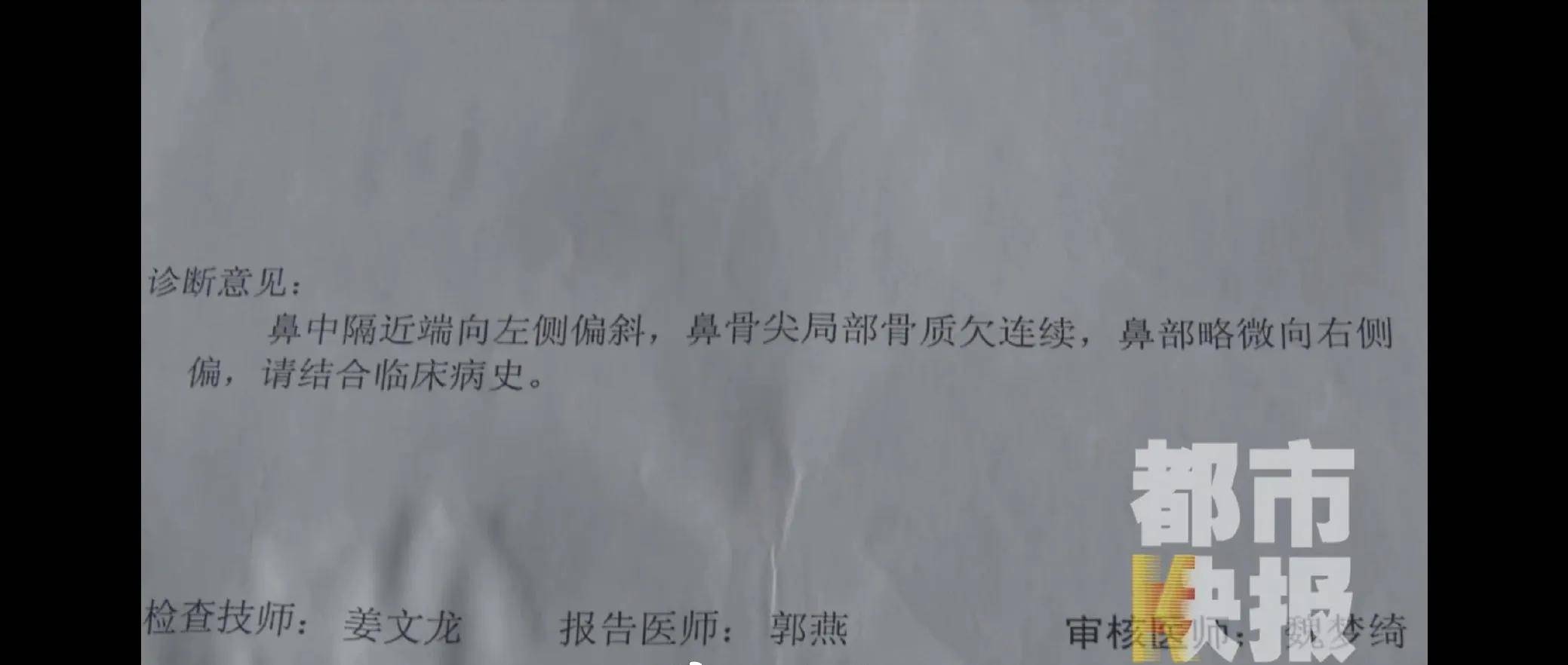 女子花9万在西安美莱医学整容医院做手术后鼻子歪了(图7)