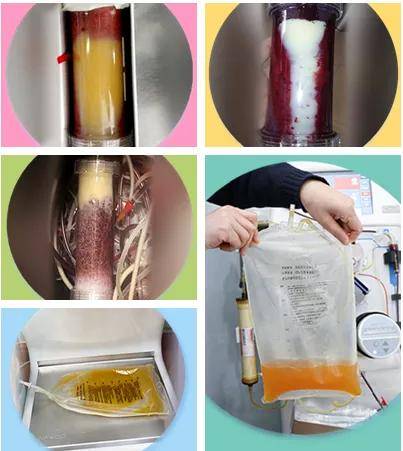 血管|三高?过敏？肤色暗沉？是时候给血液“洗个澡”啦