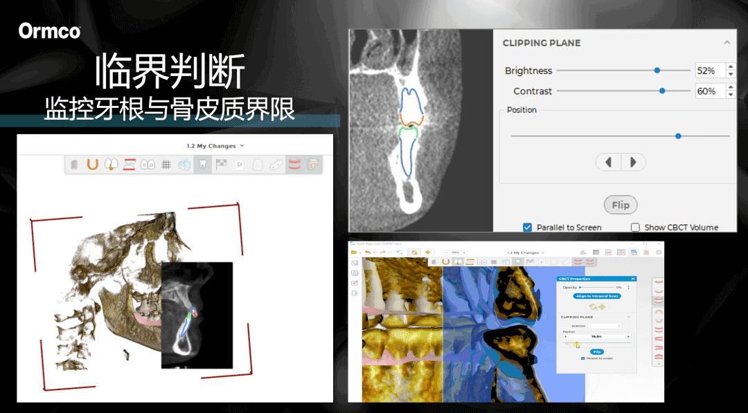 数字化|中家医家庭医生口腔与奥美科联合发起“全城征集微笑天使”活动