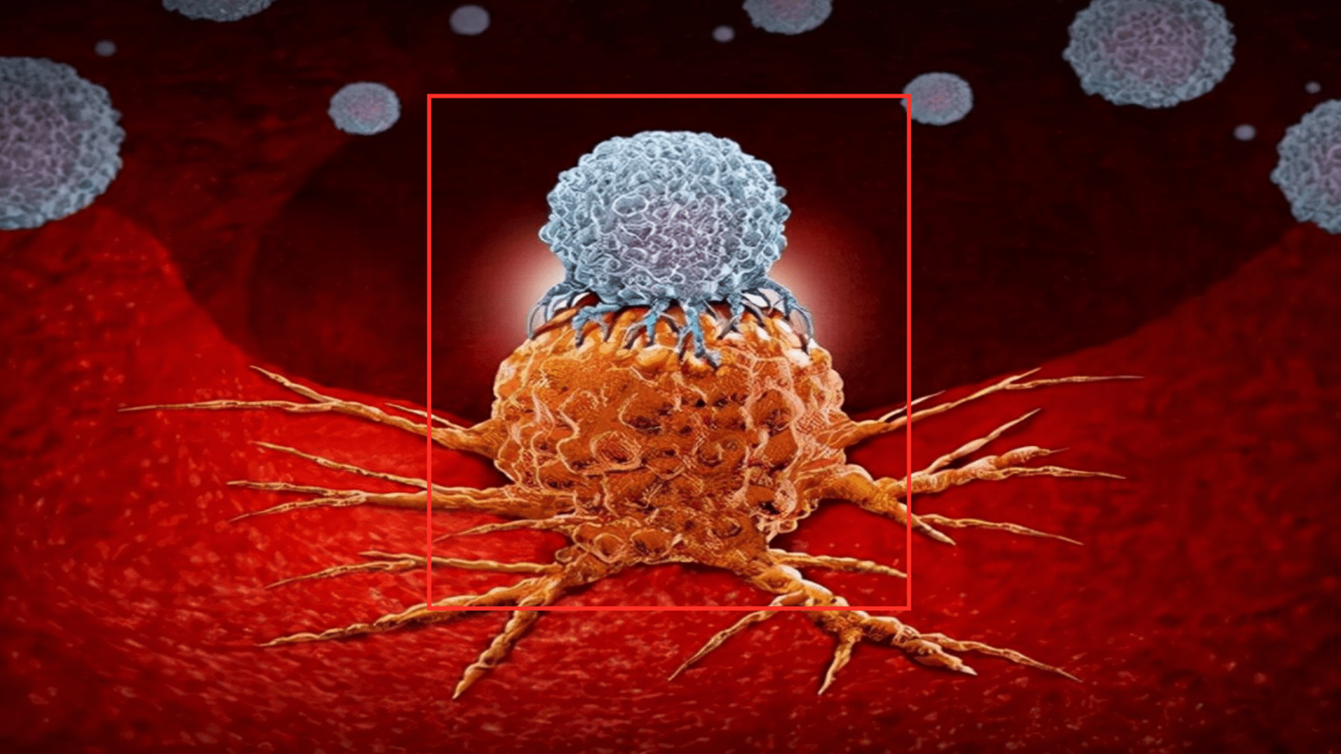 肿瘤|国产抗癌神药上市，首位患者已出院，120万一针的抗癌药