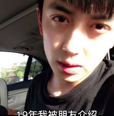 下巴|男网红整容变毁容，术后哭诉自己变老20岁，前后对比图令人诧异