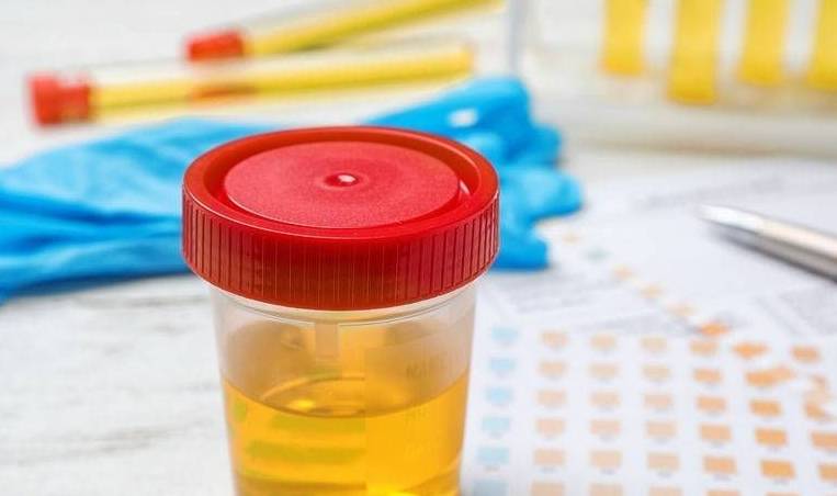 肾脏|尿液一旦“透露”出异常，需当心，这或是肾病的早期信号！