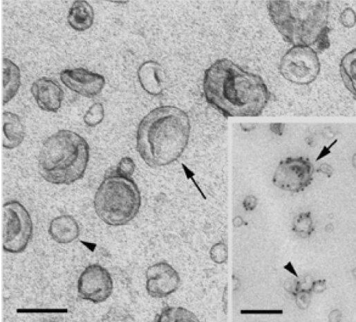 什么是外泌体和内秘体 81089f41df2b479f8b12e598f8b4b299.png