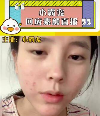 化妆品小霸宠首次透露素颜直播原因，审美跟大家不同，觉得满脸痘很好看